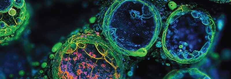 Single-Cell Workflow Overview