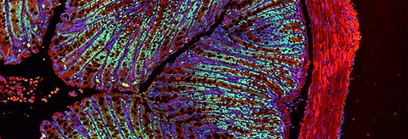 Recombinant Antibodies